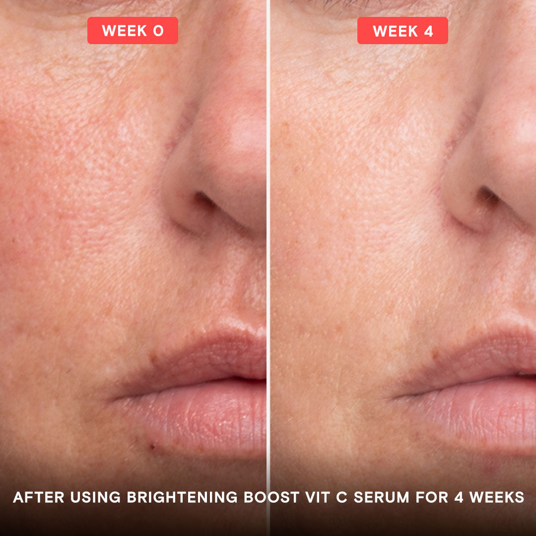 Brightening Boost Vitamin C Pro System