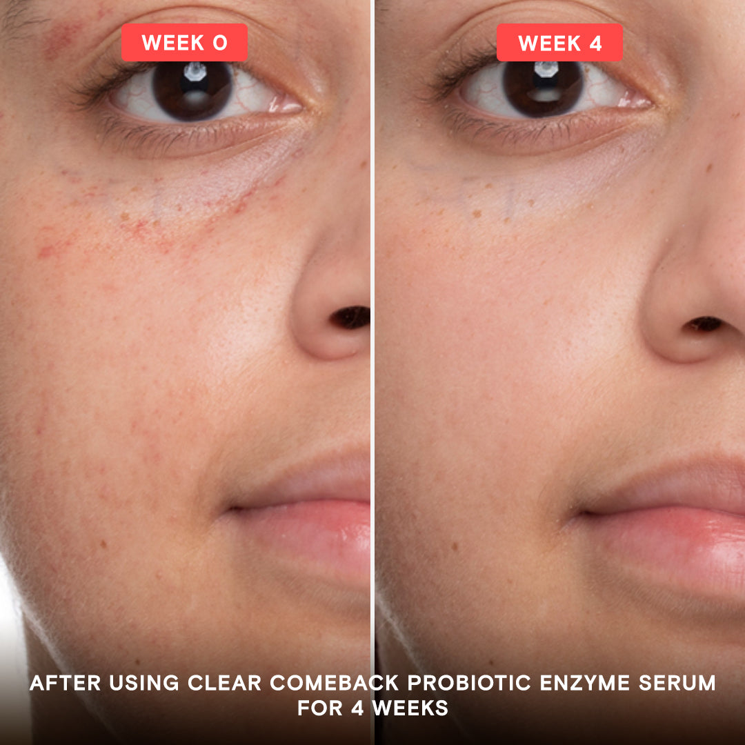 Clear Comeback Probiotic Enzyme Pro System