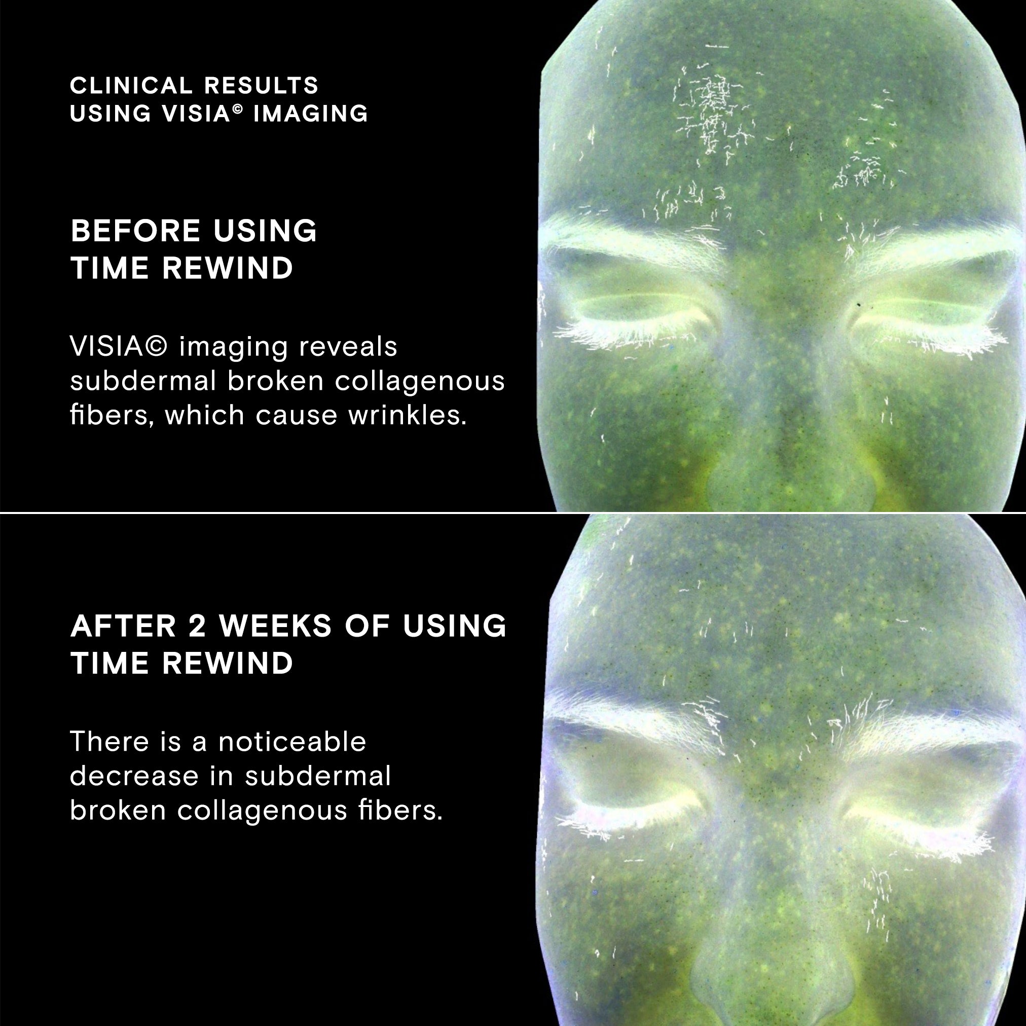 Time Rewind Retinol Pro System