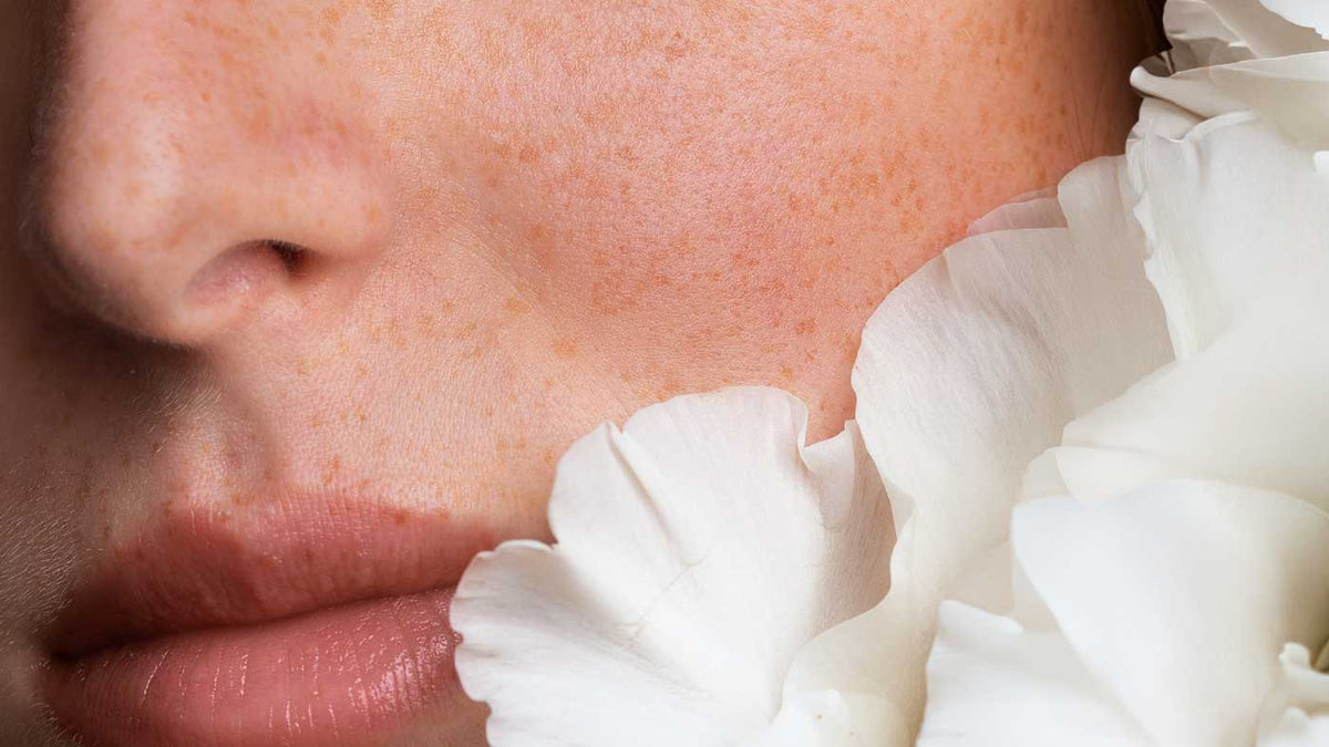 Can’t Use Retinol? How to Smooth Wrinkles with Eczema, Rosacea, or a Baby on the Way