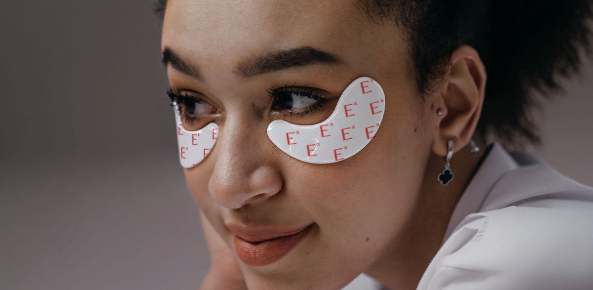 Types of Dark Circles, and Where Hesperidin Fits
