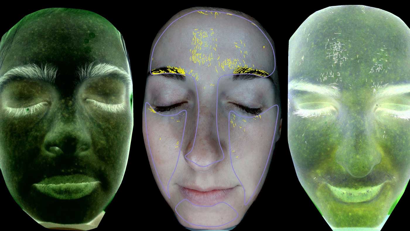 VISIA Skin Imaging: The Gold Standard in Objective Skincare Analysis