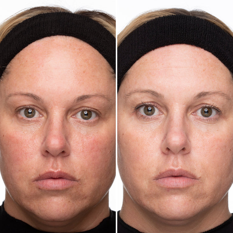Vitamin C Serum Before and After