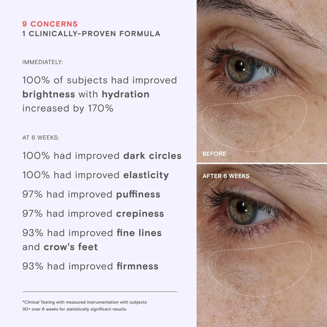 Needle-Free Lifting Eye Cream
