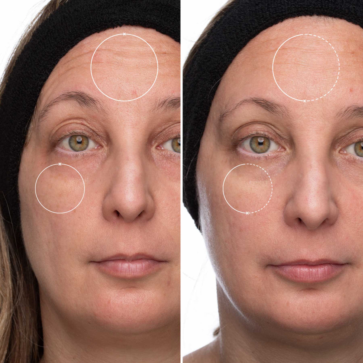Time Rewind Retinol Pro System Add On