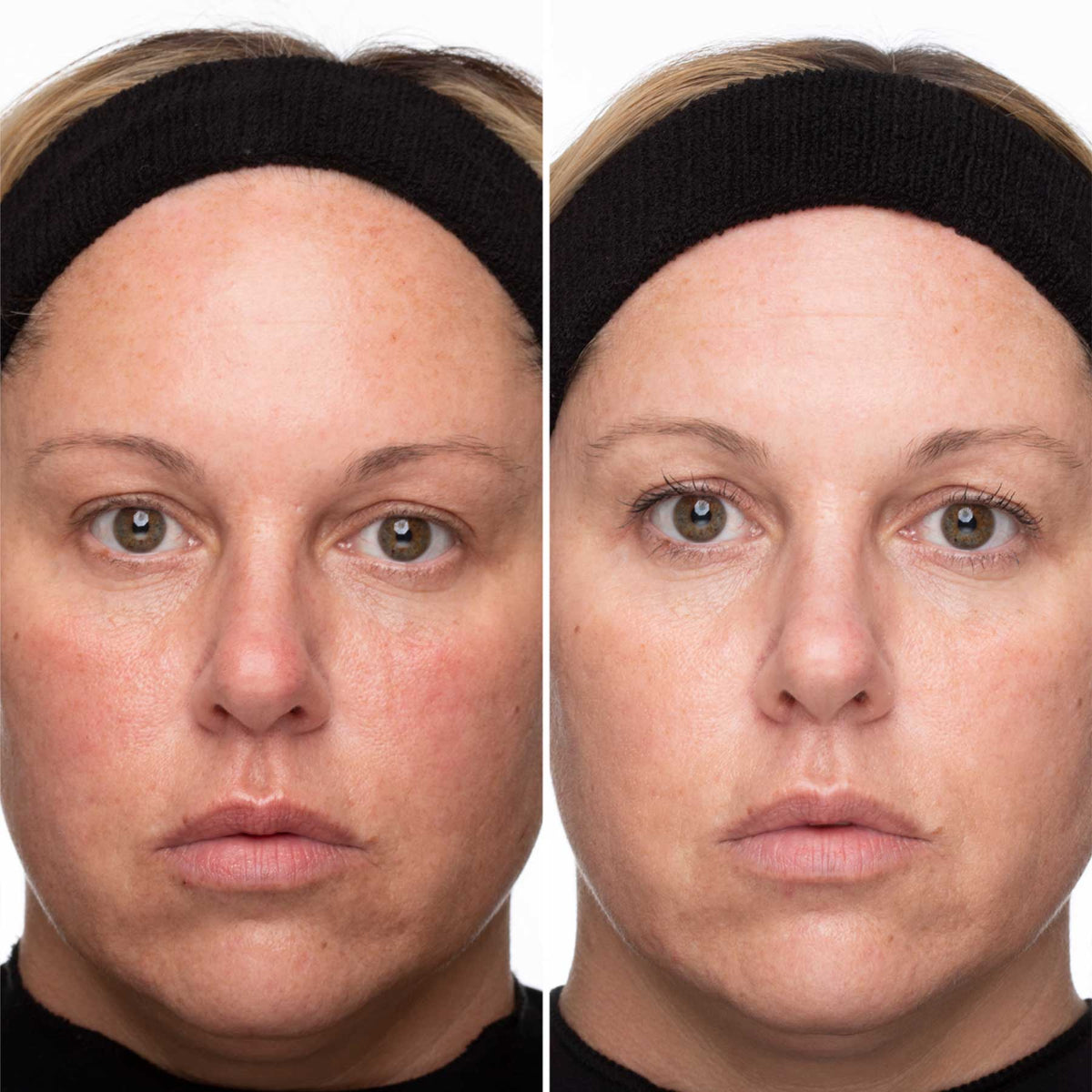 Brightening Boost Vitamin C Pro System Add On