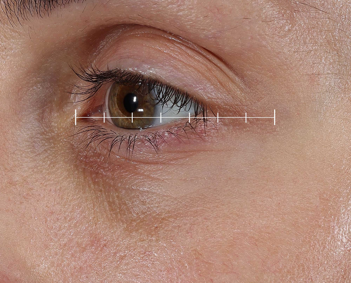 After -  - Compare