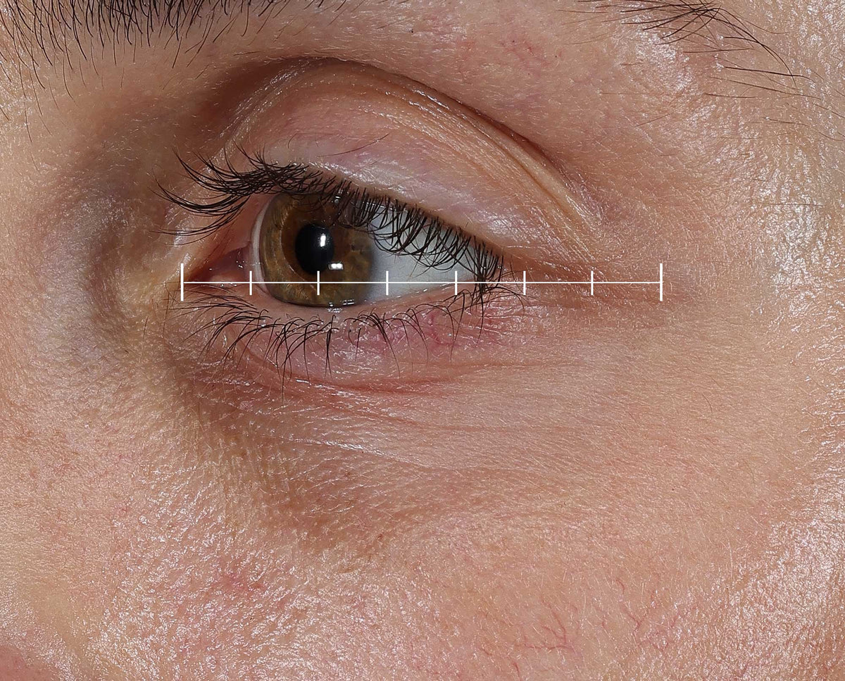 Before -  - Compare