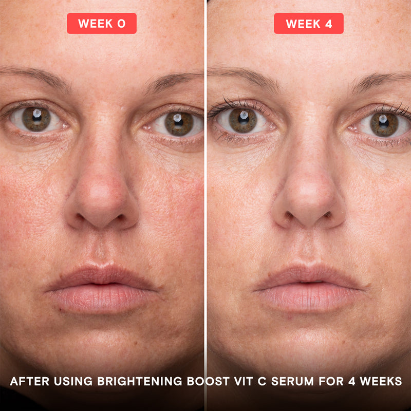 Brightening Boost Vitamin C Power- Exponent Beauty Skincare Serums