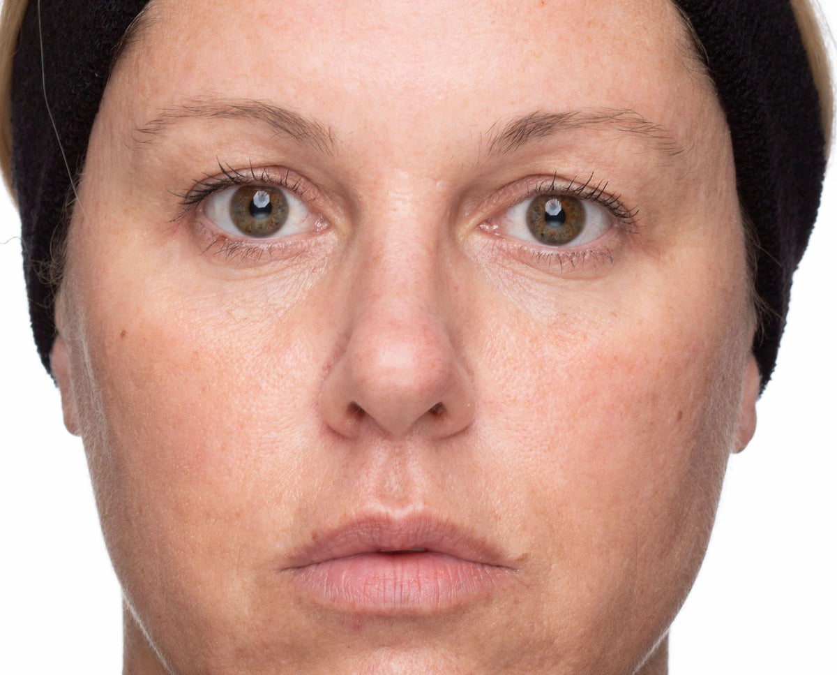 After -  - Compare