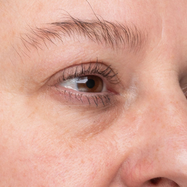 Fine lines — week 8
