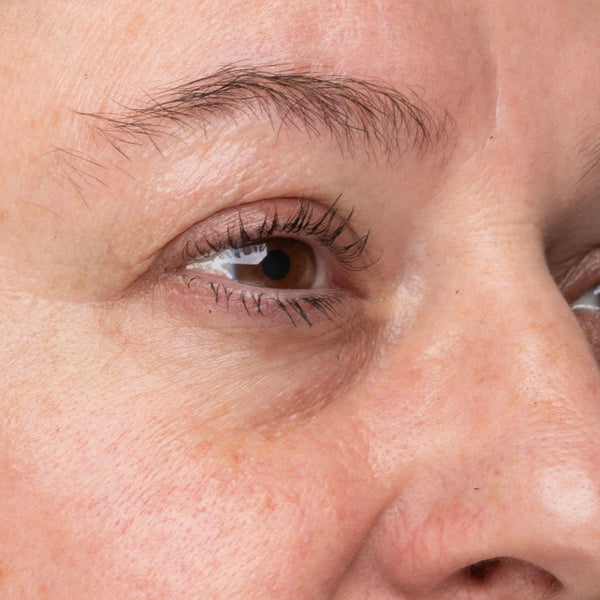 Fine lines — week 0