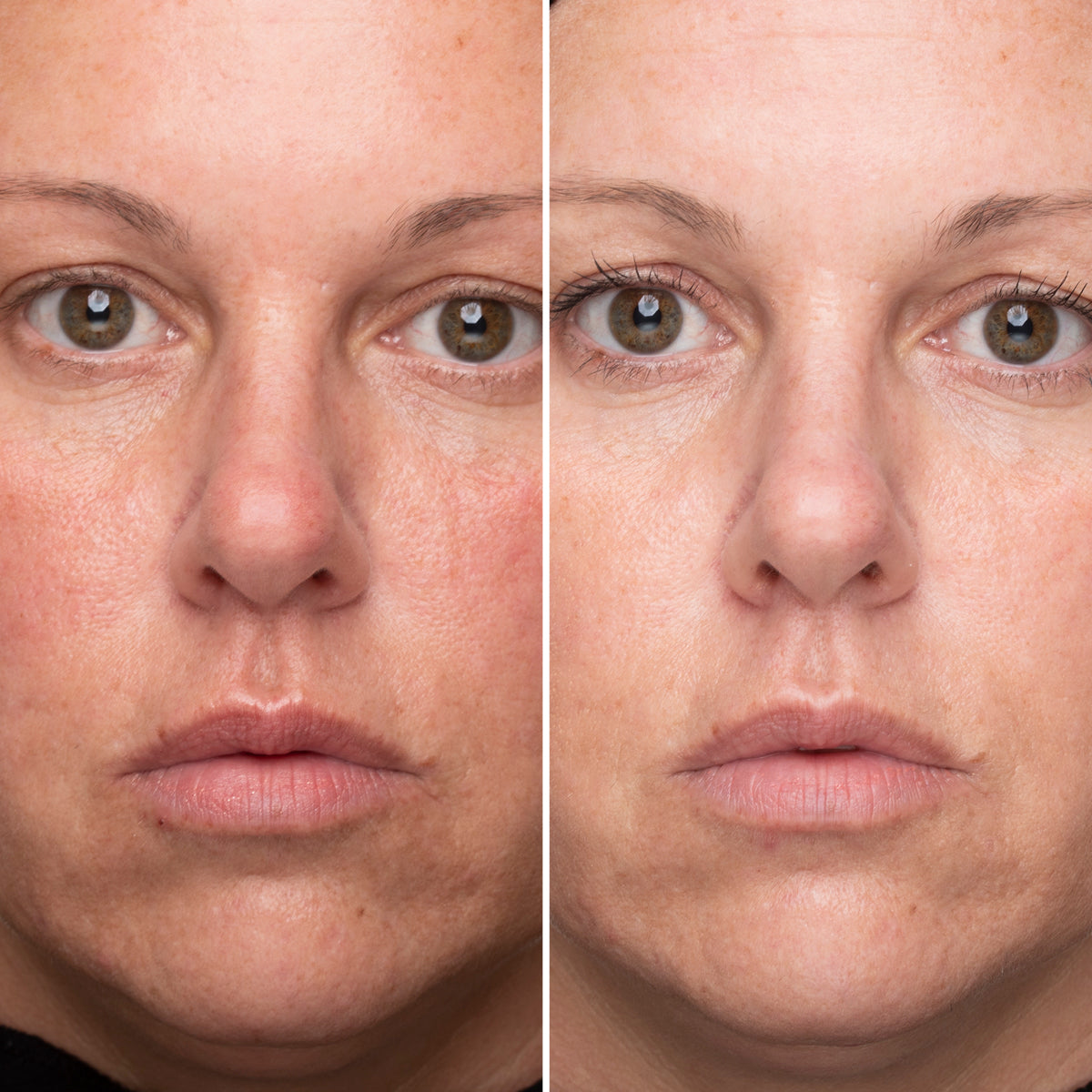 Brightening Boost Vitamin C Pro System Add On