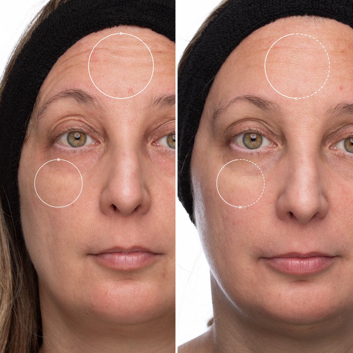 Time Rewind Retinol Pro System Add On